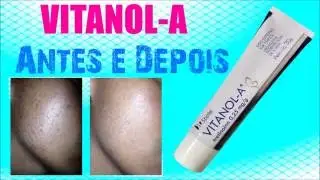 Vitanol-a antes e depois