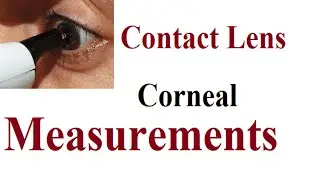 Corneal Measurements for Contact Lens