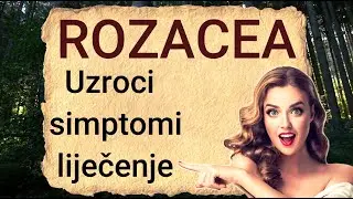 &Scaron;ta je rozacea? - Koji su uzroci, simptomi i kako se liječi? - Liječenje rozacee