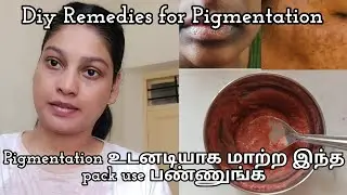Pigmentation Removal face pack in Tamil #diybeauty 