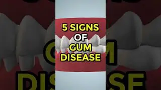 5 Signs of Gum Disease #gumdisease #ytshorts
