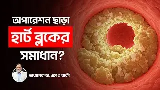 সার্জারি ছাড়া হার্ট ব্লকের সহজ চিকিৎসা | Heart Blockage Treatment Without Surgery Bangla