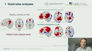 OHBM 2025 | Symposium | Tobias Bauer | Brain network organisation in the isolated hemisphere of pe&hellip;