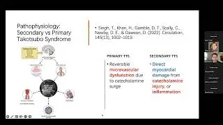 Secondary Takotsubo Syndrome: An Update - Pengyang Li, MD, MS