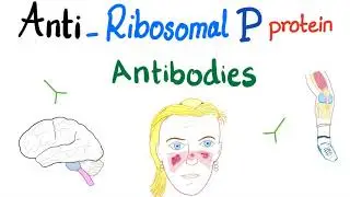 Anti-Ribosomal P Protein Antibodies