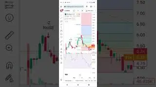 mdgs stocks technical analysis
