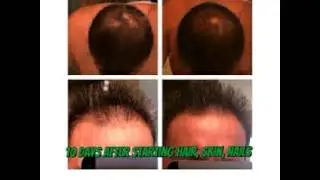 It Works, Hair Skin Nails