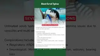 About Scrub Typhus Infection | Cause, Mode of Transmission, Signs & Symptoms, Prevention & Treatment