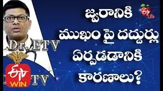 Is a Rash Common After a Fever ? | Dr ETV | 5th March 2020 | ETV Life