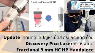 Updateเทคนิคดูแลปัญหาเม็ดสี Discovery Pico Laser หัวยิงเลเซอร์พิเศษ Fractional 9 mm HC HP Handpiece