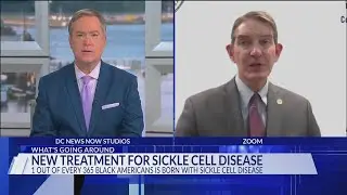 Top DC doctor reacts to new sickle cell treatment
