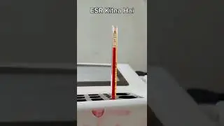 How are ESR #labstaff #lab #labtechnician #science #viral #blood #hospital #medical