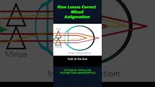 How lenses correct Mixed Astigmatism