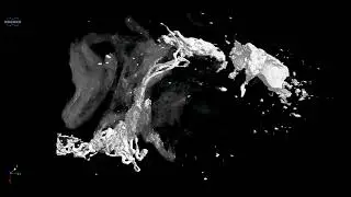 Casmara Gut Structure using Micro-CT
