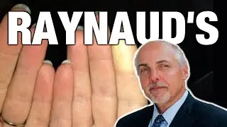White Fingers | Cold Fingers | Raynaud's