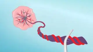 Genecord Cord Blood Collection Instructional Video