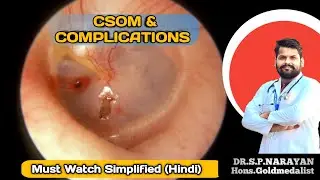 CSOM And Complications In simplified(Hindi )