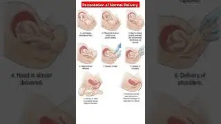 Prasentetion of Normal Delivery #midwifery #medicaleducation #anm2ndyear