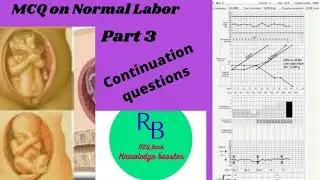 MCQ on Normal Labor Part 3 Continuation questions...