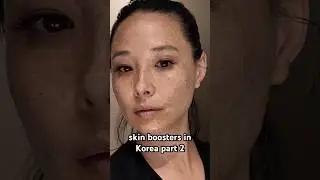 day 2 after Rejuran Healer and Juvelook #koreanskincare #juvelook #rejuran #skinbooster