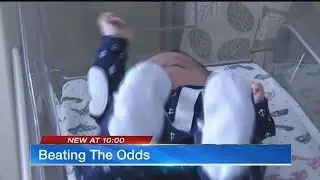 Miracle twins born at 23 weeks beat odds, head home from NICU