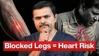 The SURPIRSING Link Between Leg Pain and 5x Higher Heart Attack Risk
