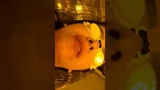 Despigmentação Labial, removendo micropigmentação dos lábios.