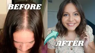 Tips for thin hair | PCOS hair loss + Products & Advice for healthy, stronger hair!
