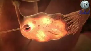 3d animation of how IVF Works math rahul kumar 12345 12345 12345