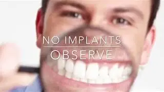 Retention on Lower Dentures
