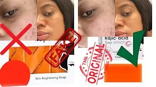 How to Spot Fake vs. Original Kojic Acid Soap: A Complete Guide