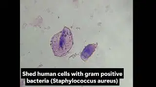 Staphylococcus aureus bacteria in shed cells, observed with DIPLE