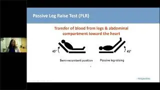 Sepsis  Are we doing enough for our patients