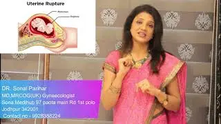 cesarean के बाद normal delivery possible  है?  कितने  cesarean करवा सकते है