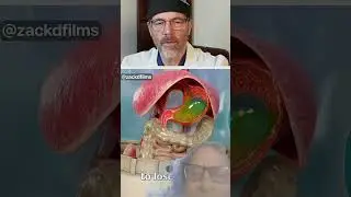 how a gastric bulb works #satisfying #funny #food #utube #ramesh uttam