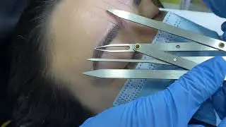 Como usar compasso &aacute;ureo 4 pontas