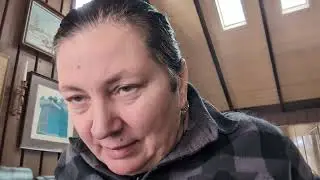 Цервикальная дистония. Кривошея у взрослых. Упражнения