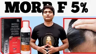 morr f 5 results | morr f 5 review | morr f 5 uses in hindi | morr f 5 minoxidil and finasteride