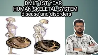 Disease and disorders of human skeletal system||dmlt||b.sc||neet||part:9