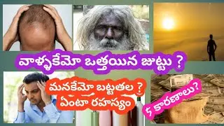 What is the secret behind their thick hair and our baldness? What are the 5 reasons?