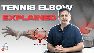 Tennis Elbow Explained | Causes, Symptoms & Simple Solutions for Pain Relief! | Dr. Aditya Soral