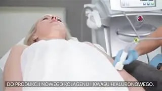 Spos&oacute;b na cellulit z Venus Legacy
