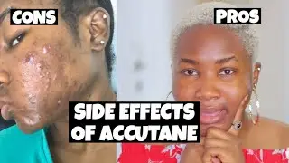 IS ACCUTANE SAFE? ARE THE SIDE EFFECT DANGEROUS? (skin purging, dry skin/eyes etc) | OLUCHI UKAH