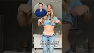 Tummy Tuck Transformation - Surgeon Reacts