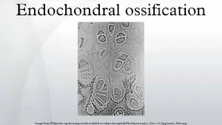 Endochondral ossification