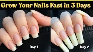 नाखून कैसे बढ़ाएं how to grow nails strong and long/faster nail growth/nails growth fast and faster🤘