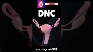 DNC|d&c|dilatation and Curratage| dilatation and Curratage procedure|D and C|dnc