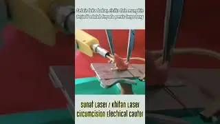 Metode Sunat Laser, Bak Bakar Sate, Sebaiknya Orangtua lihat video ini sebelum menyunatkan buah hati