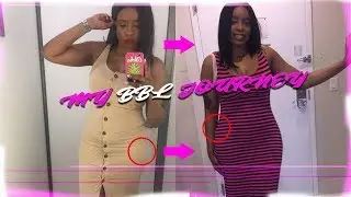 My BBL JOURNEY! Part 1 of 4
