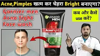 Garnier Men Acno Fight Face Wash | acno fight face wash | garnier face wash